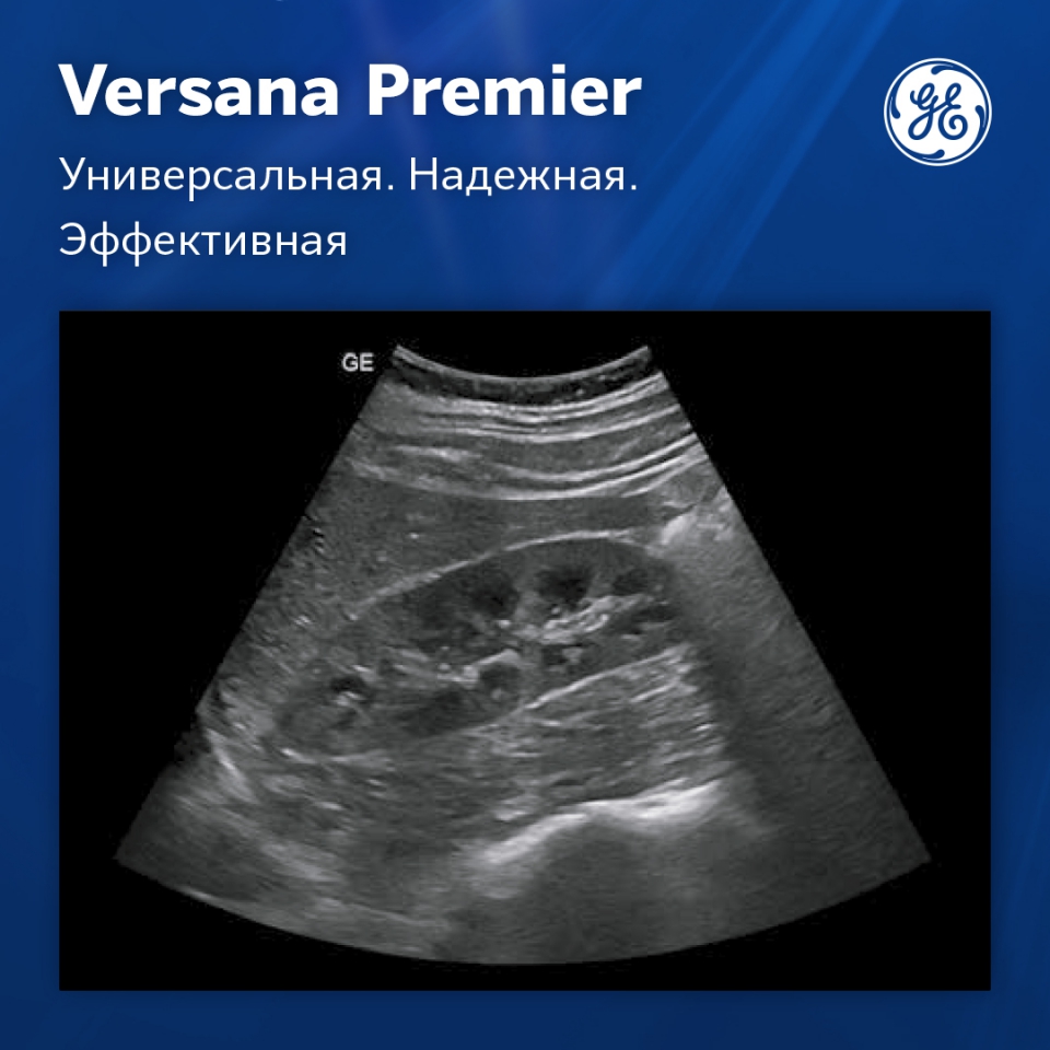 GE Versana Premier black