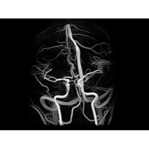 МРТ аппарат GE Optima MR450w 1.5T