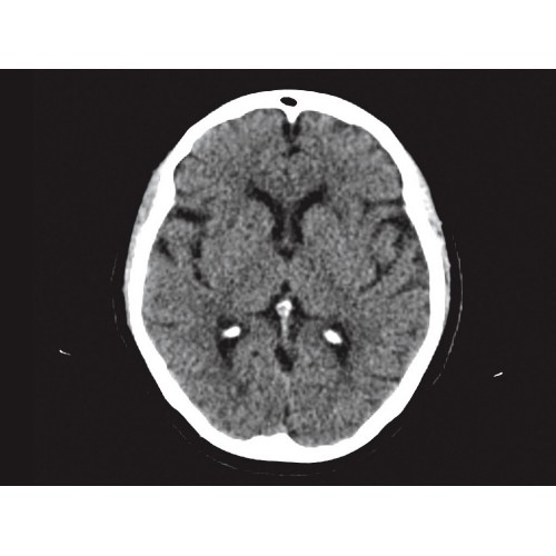 КТ аппарат GE Brivo CT385