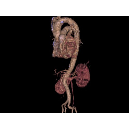 КТ аппарат GE Brivo CT385